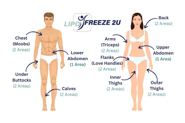 Areas you can have fat freezing treatment Hemel Hempstead