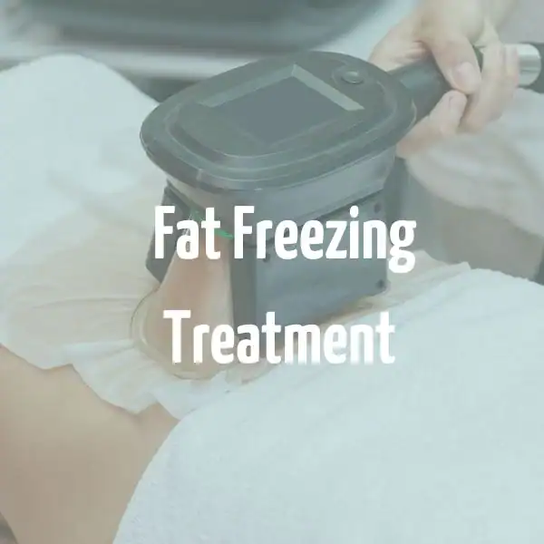 fat freezing treatment Hemel Hempstead