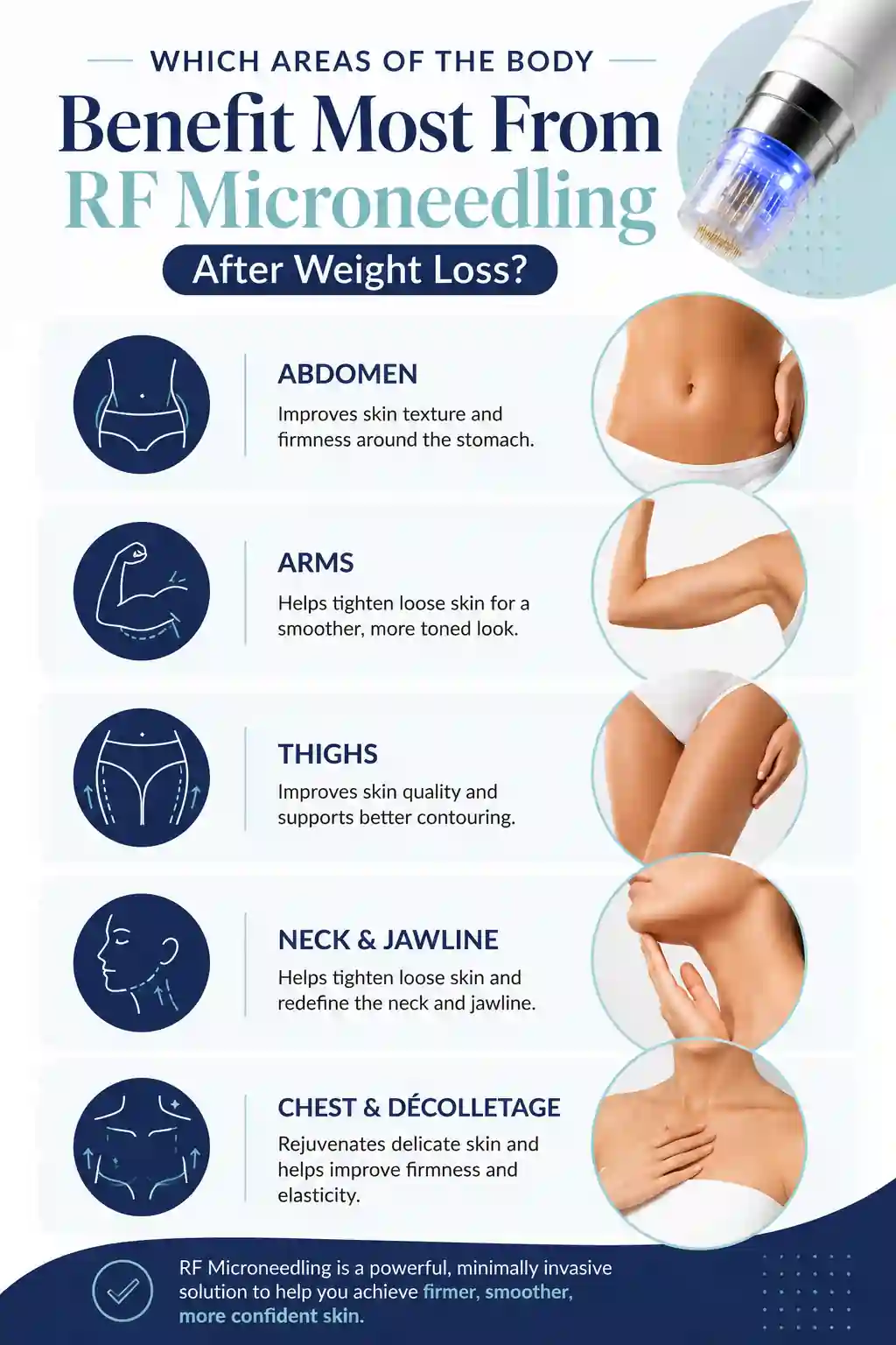 Which Areas of the Body Benefit Most From RF Microneedling After Weight Loss Hemel Hempstead